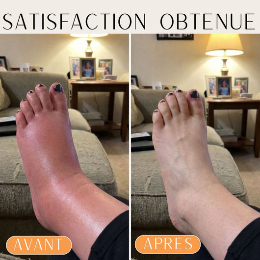 Masseur Intelligent de pied et de cheville (SOINFOOT™)